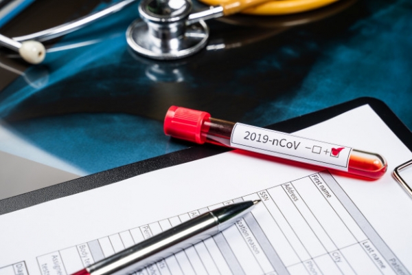 У Кропивницькому секретар міської ради захворів на COVID-19